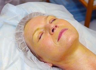 Процедуры, вызывающие шелушение кожи лица